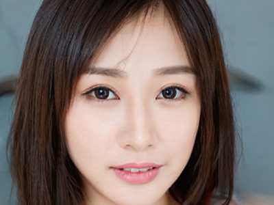 王永久整形医生医术如何好吗医生个人资料合资假体垫下巴案例